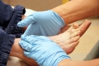 Why Diabetics Should Be Cautious With Their Feet